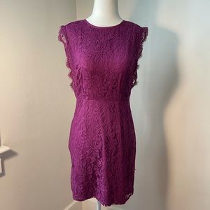 Urban Outfitters Lace Dress